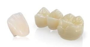 Laboratorio odontotenico Roma