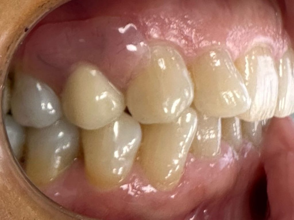 SOLUZIONI DENTALI NON INVASIVE