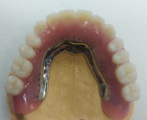 laboratorio odontotecnico Roma